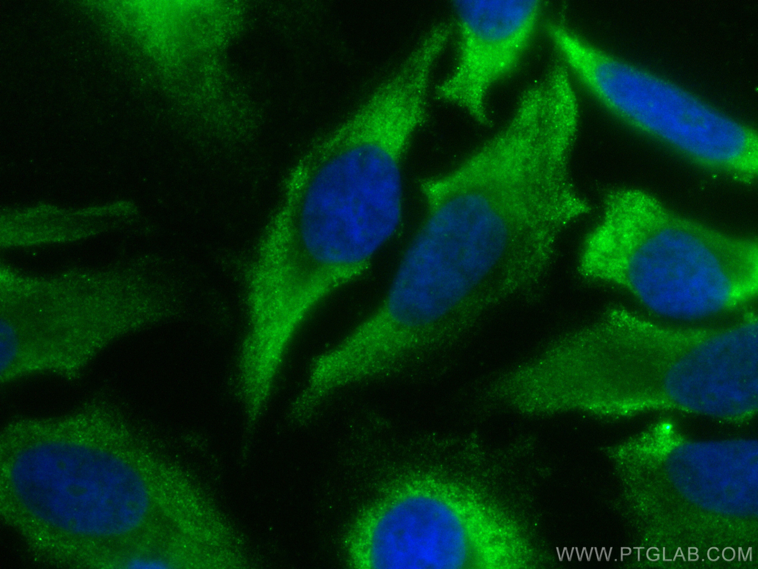 Immunofluorescence (IF) / fluorescent staining of HeLa cells using CoraLite® Plus 488-conjugated RPS27A Polyclonal an (CL488-14946)