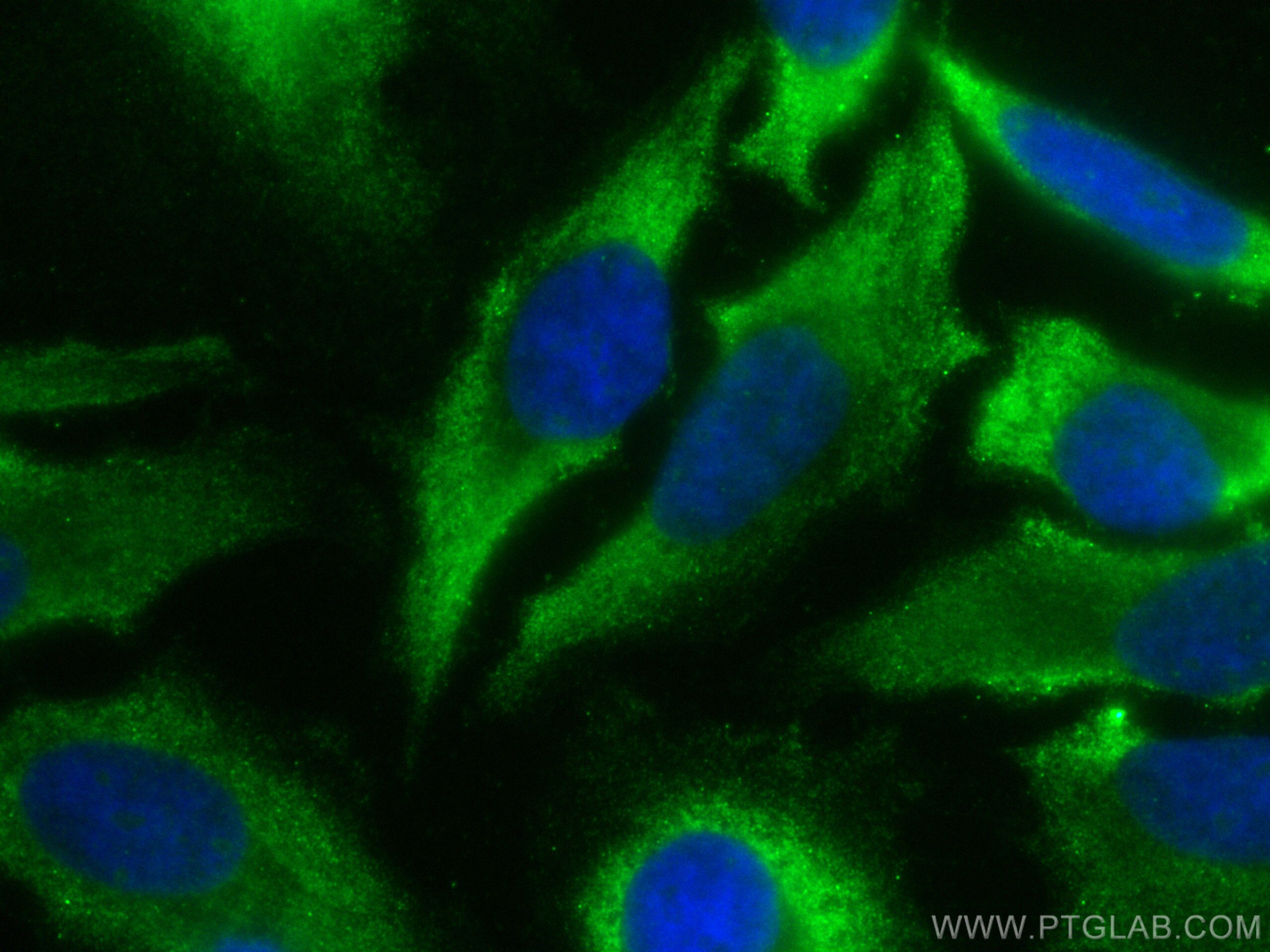 Immunofluorescence (IF) / fluorescent staining of HeLa cells using CoraLite® Plus 488-conjugated RPS27A Polyclonal an (CL488-14946)