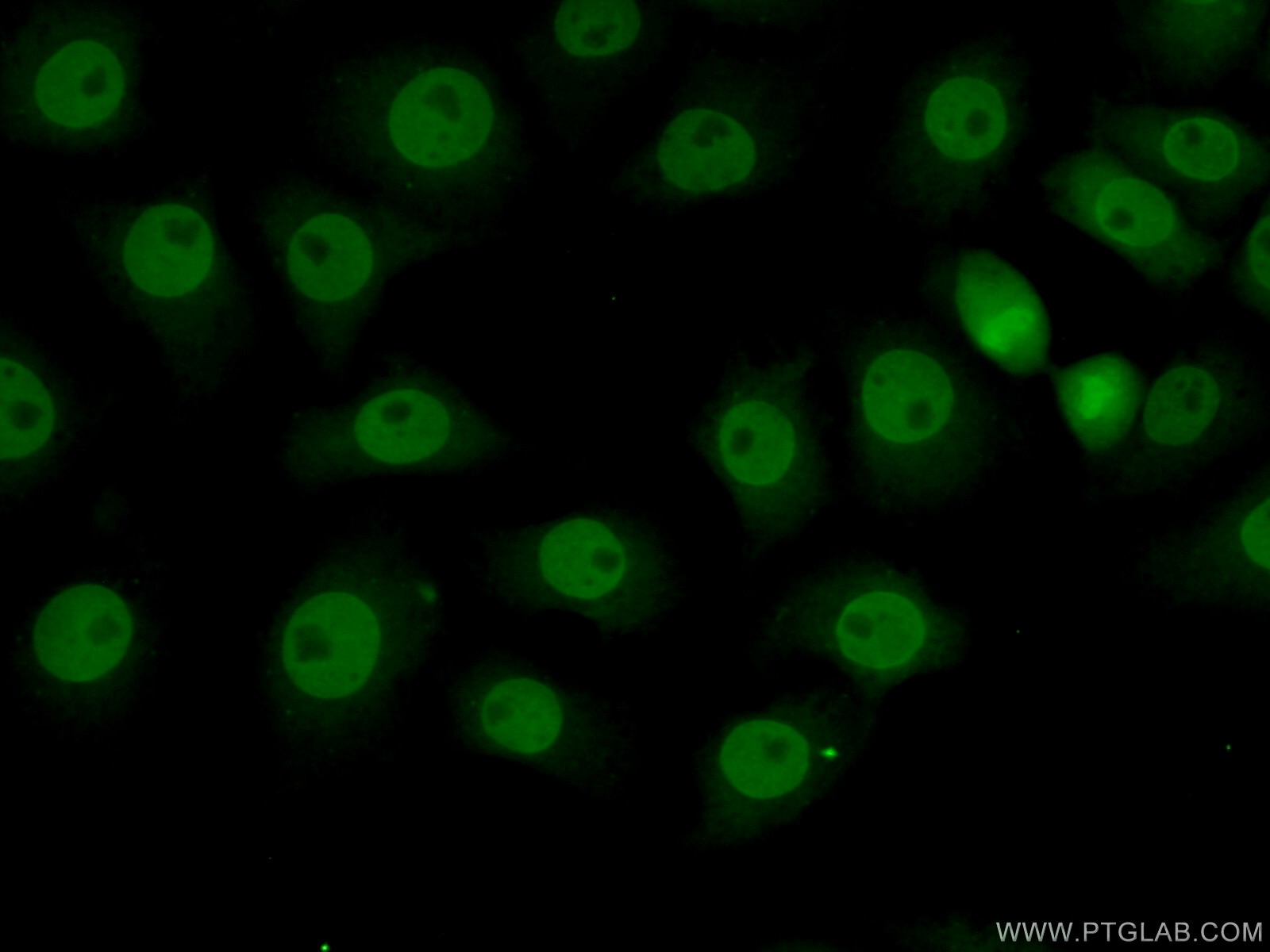Immunofluorescence (IF) / fluorescent staining of SH-SY5Y cells using RPS27L Polyclonal antibody (15871-1-AP)