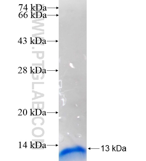 RPS29 fusion protein Ag11356 SDS-PAGE
