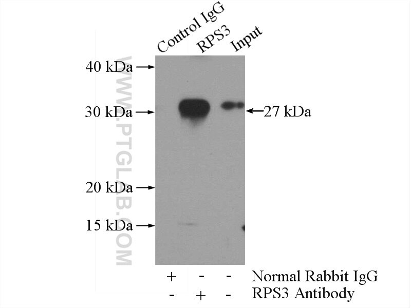 IP experiment of mouse testis using 11990-1-AP