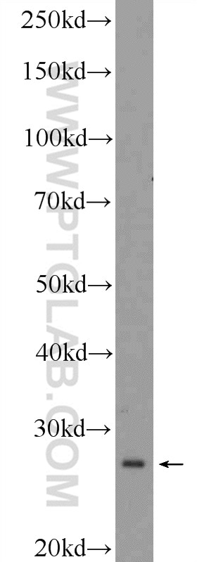 WB analysis of PC-12 using 11990-1-AP