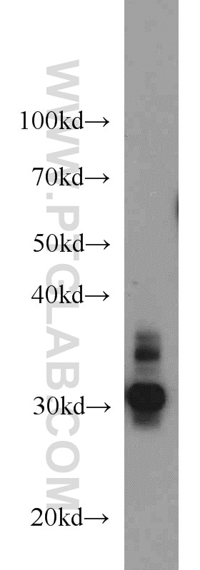 Western Blot (WB) analysis of mouse colon tissue using RPS3 Polyclonal antibody (15198-1-AP)