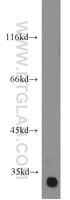 Western Blot (WB) analysis of rat brain tissue using RPS3 Polyclonal antibody (15198-1-AP)