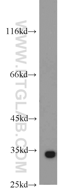 Western Blot (WB) analysis of mouse brain tissue using RPS3 Polyclonal antibody (15198-1-AP)