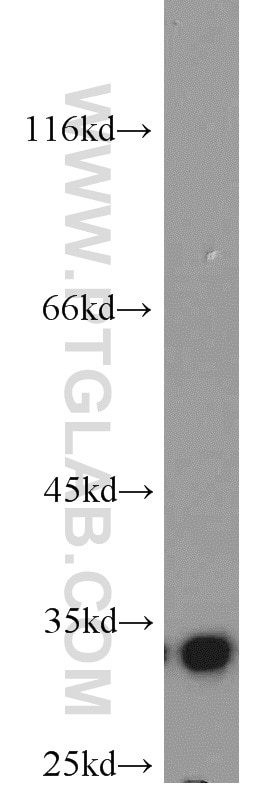 Western Blot (WB) analysis of mouse brain tissue using RPS3 Polyclonal antibody (15198-1-AP)