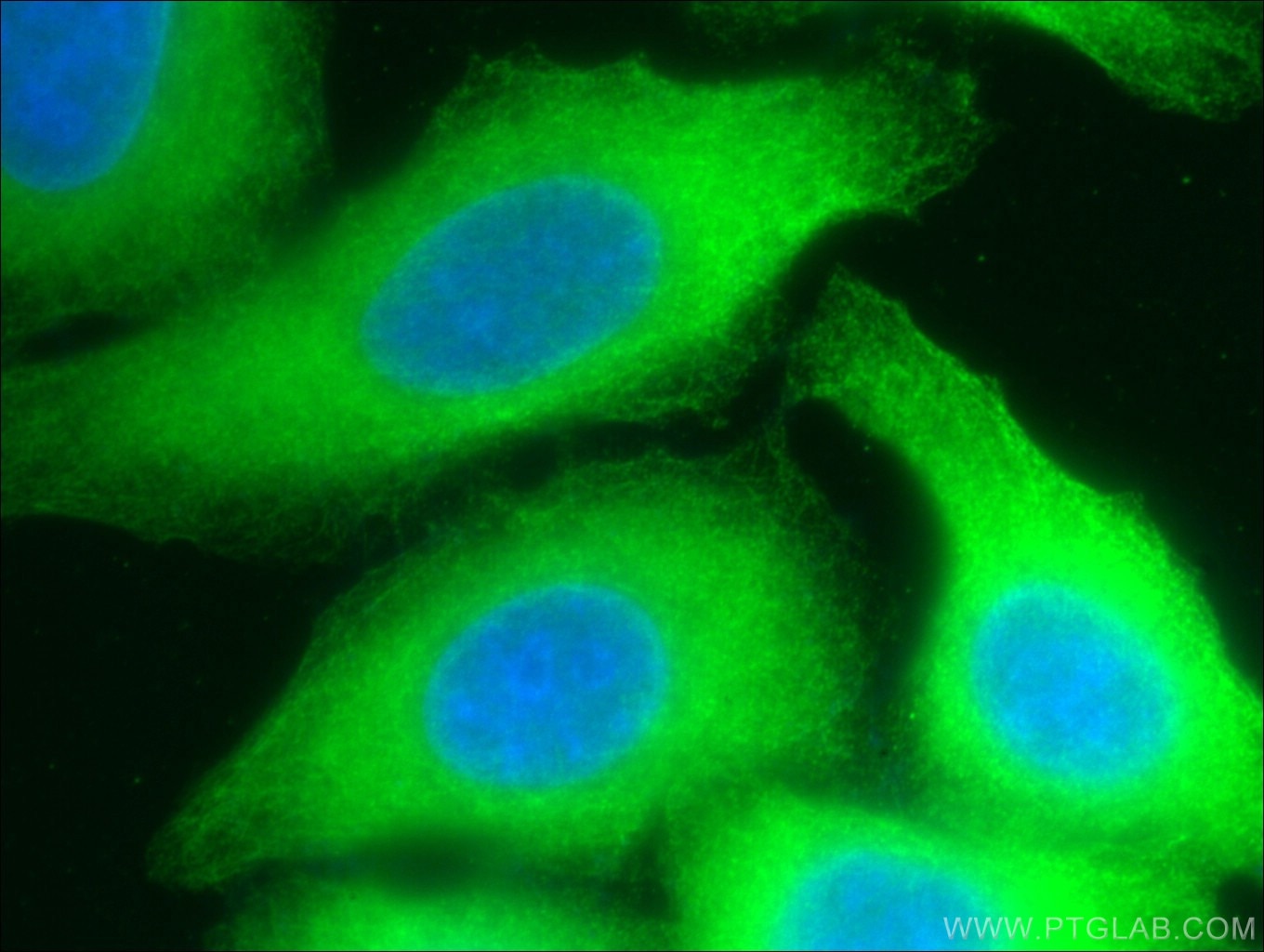 Immunofluorescence (IF) / fluorescent staining of HepG2 cells using RPS3 Monoclonal antibody (66046-1-Ig)