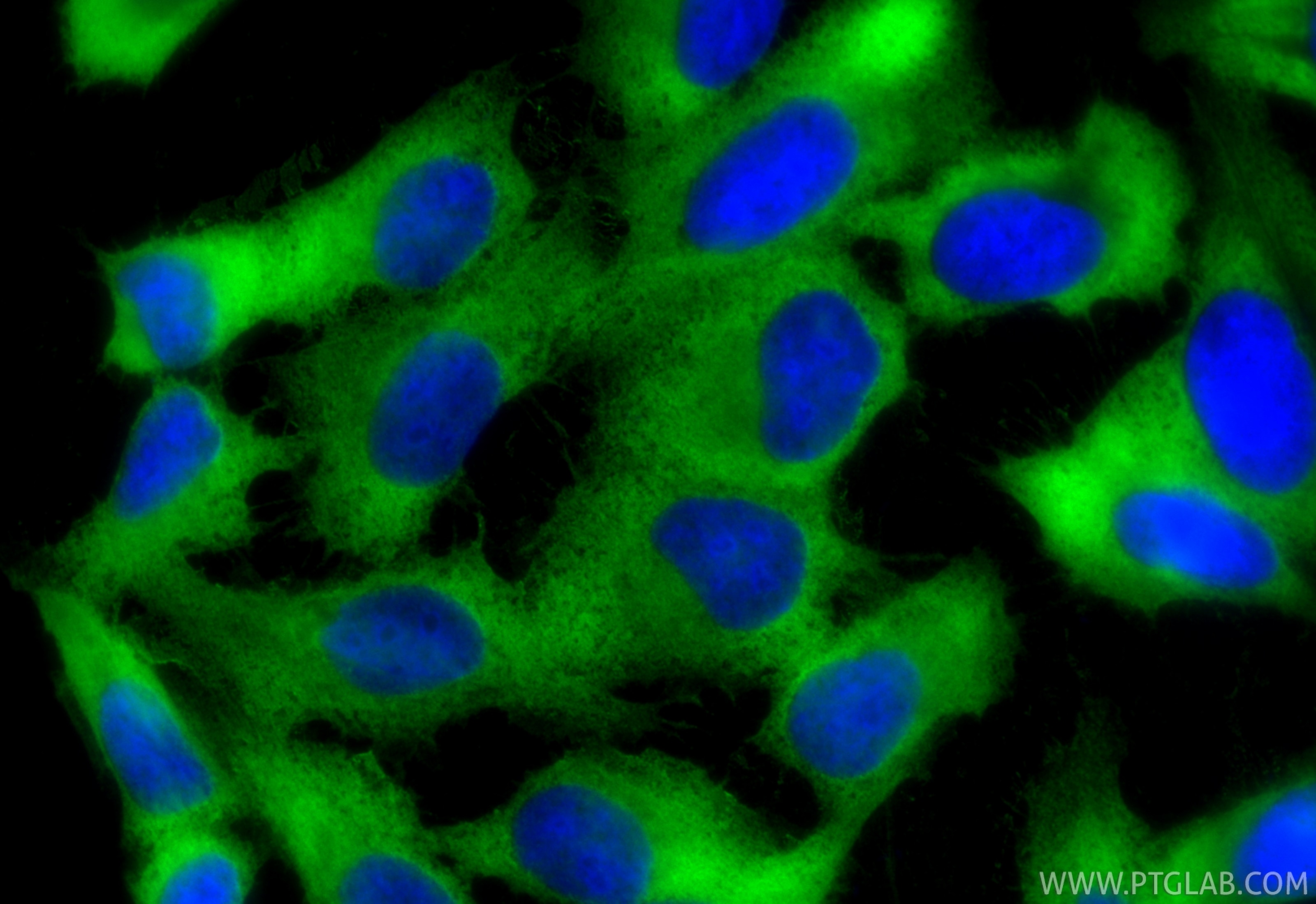 Immunofluorescence (IF) / fluorescent staining of U2OS cells using RPS3 Monoclonal antibody (66046-1-Ig)