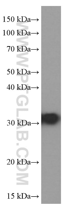 WB analysis of Neuro-2a using 66046-1-Ig