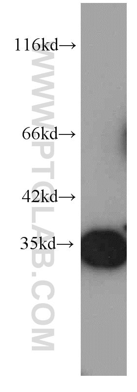 Western Blot (WB) analysis of human brain tissue using RPS3 Monoclonal antibody (66046-1-Ig)