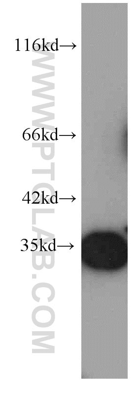 WB analysis of human brain using 66046-1-Ig