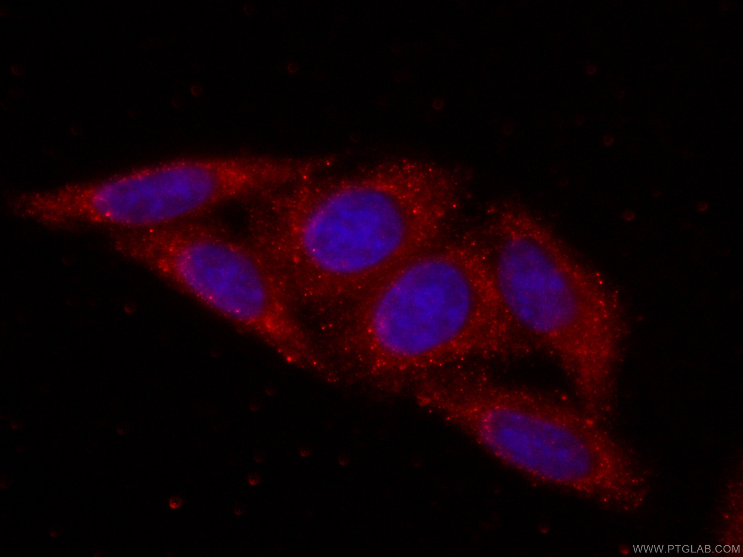 Immunofluorescence (IF) / fluorescent staining of HepG2 cells using CoraLite®594-conjugated RPS3 Monoclonal antibody (CL594-66046)