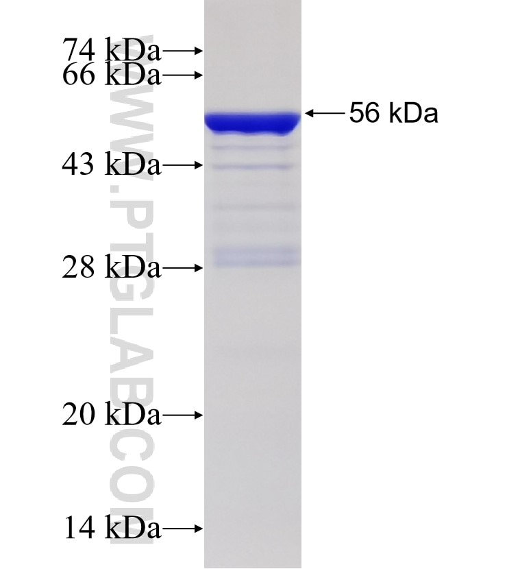 RPS3 fusion protein Ag3918 SDS-PAGE