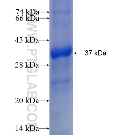 RPS3 fusion protein Ag7515 SDS-PAGE