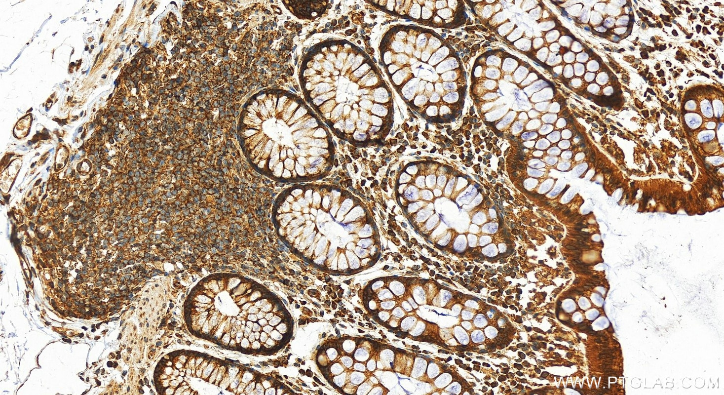 Immunohistochemistry (IHC) staining of human colon tissue using RPS3A Polyclonal antibody (14123-1-AP)