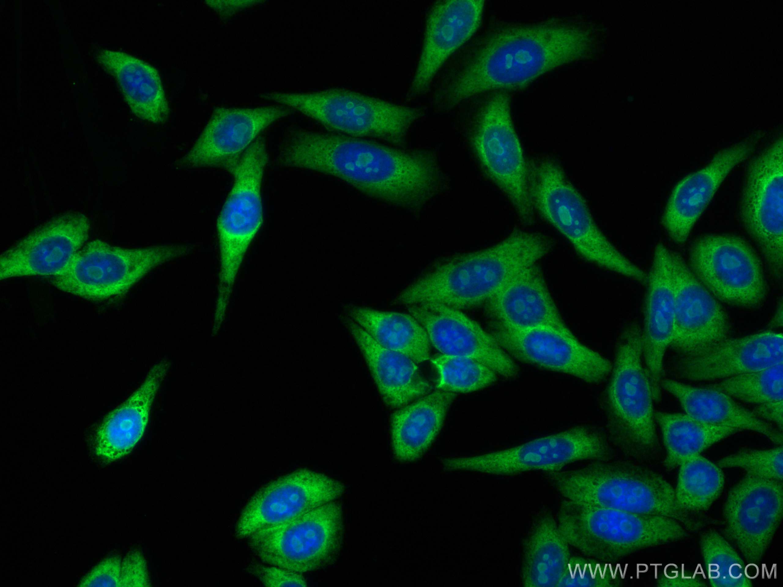 Immunofluorescence (IF) / fluorescent staining of HepG2 cells using RPS3A Polyclonal antibody (14123-1-AP)