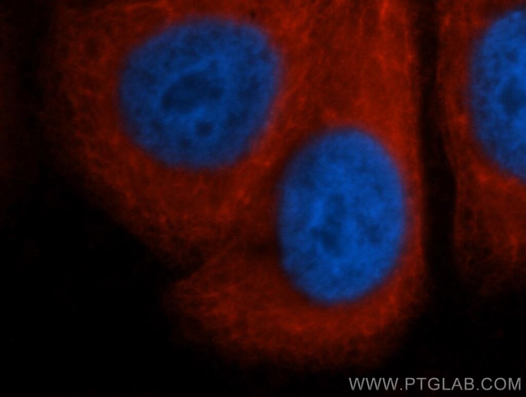 RPS3A Polyclonal antibody