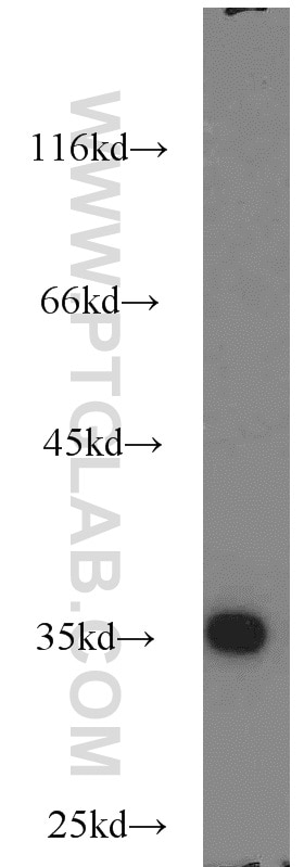 Western Blot (WB) analysis of A431 cells using RPS3A Polyclonal antibody (14123-1-AP)