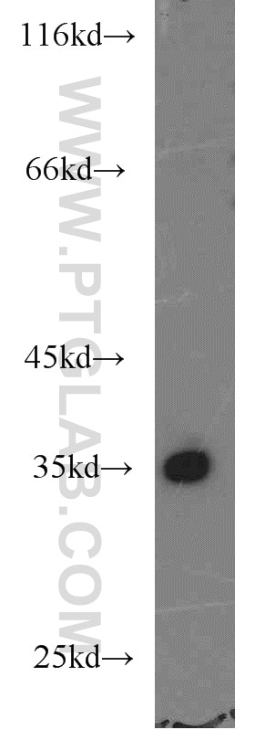 Western Blot (WB) analysis of Jurkat cells using RPS3A Polyclonal antibody (14123-1-AP)