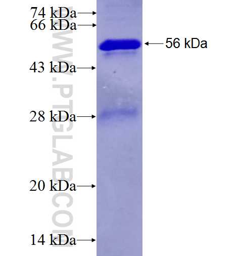 RPS3A fusion protein Ag5273 SDS-PAGE