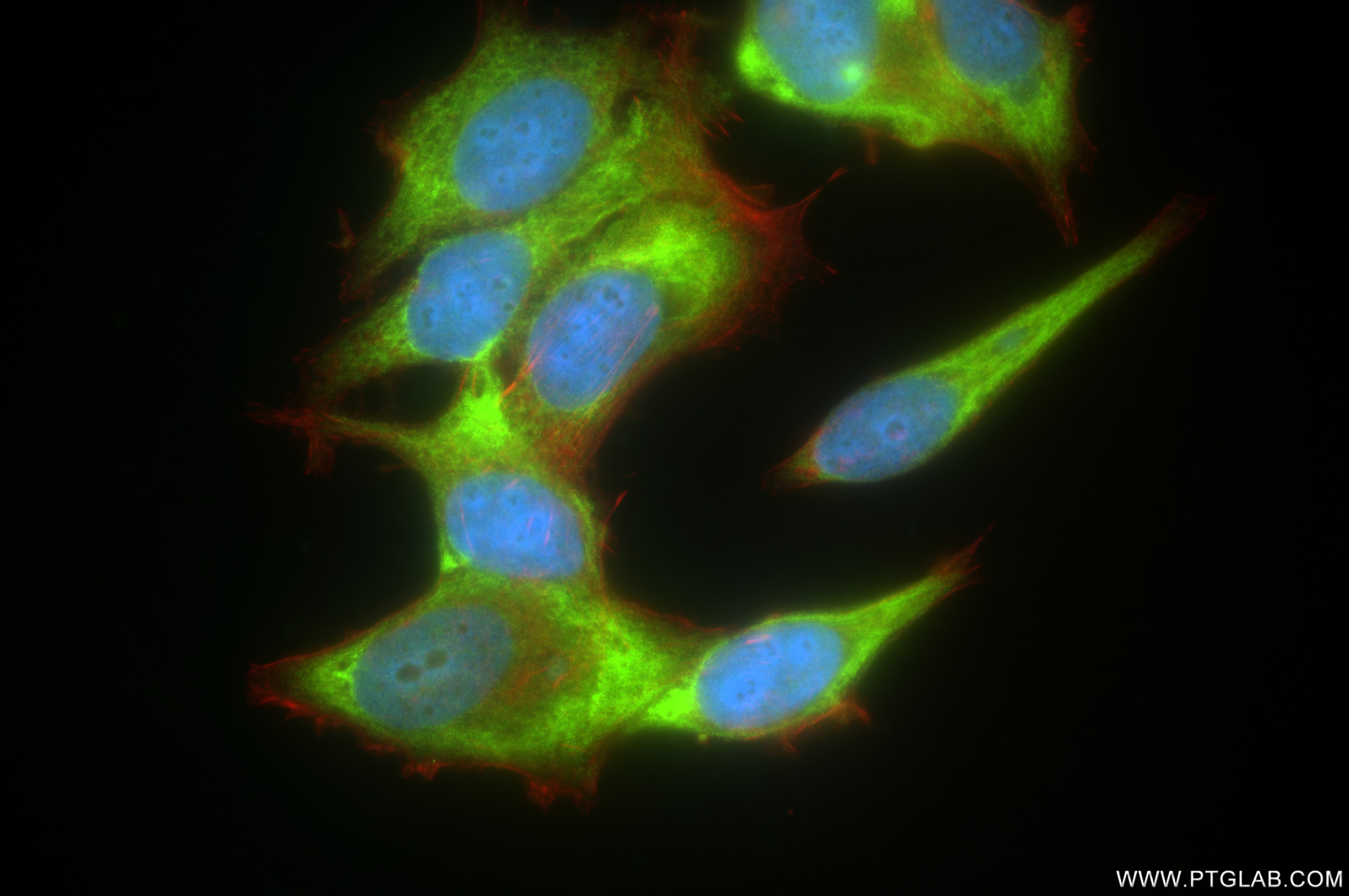 Immunofluorescence (IF) / fluorescent staining of MCF-7 cells using RPS4X Recombinant antibody (85040-5-RR)