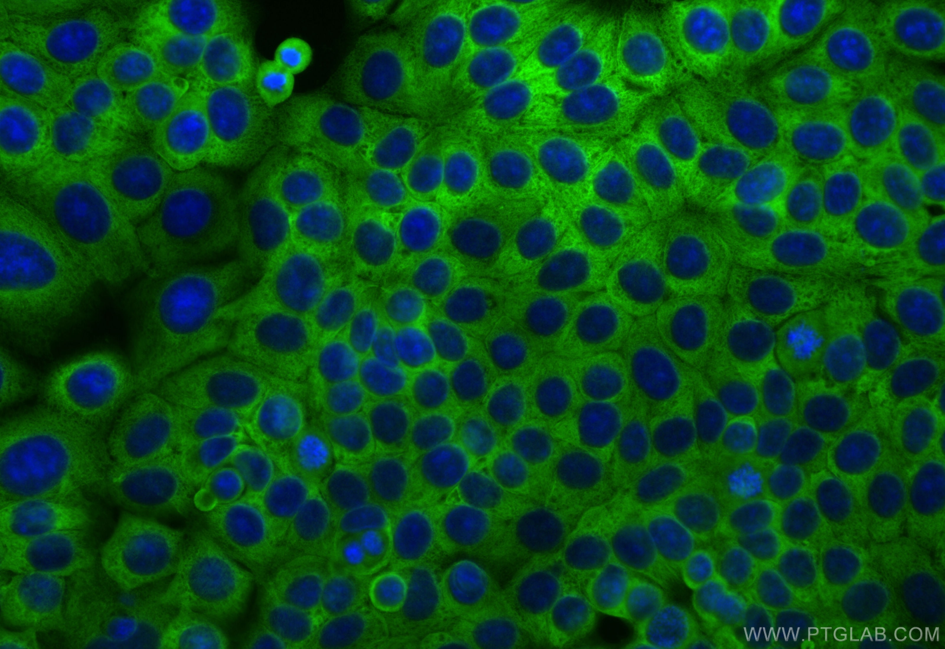 Immunofluorescence (IF) / fluorescent staining of MCF-7 cells using RPS4X Recombinant antibody (85040-5-RR)