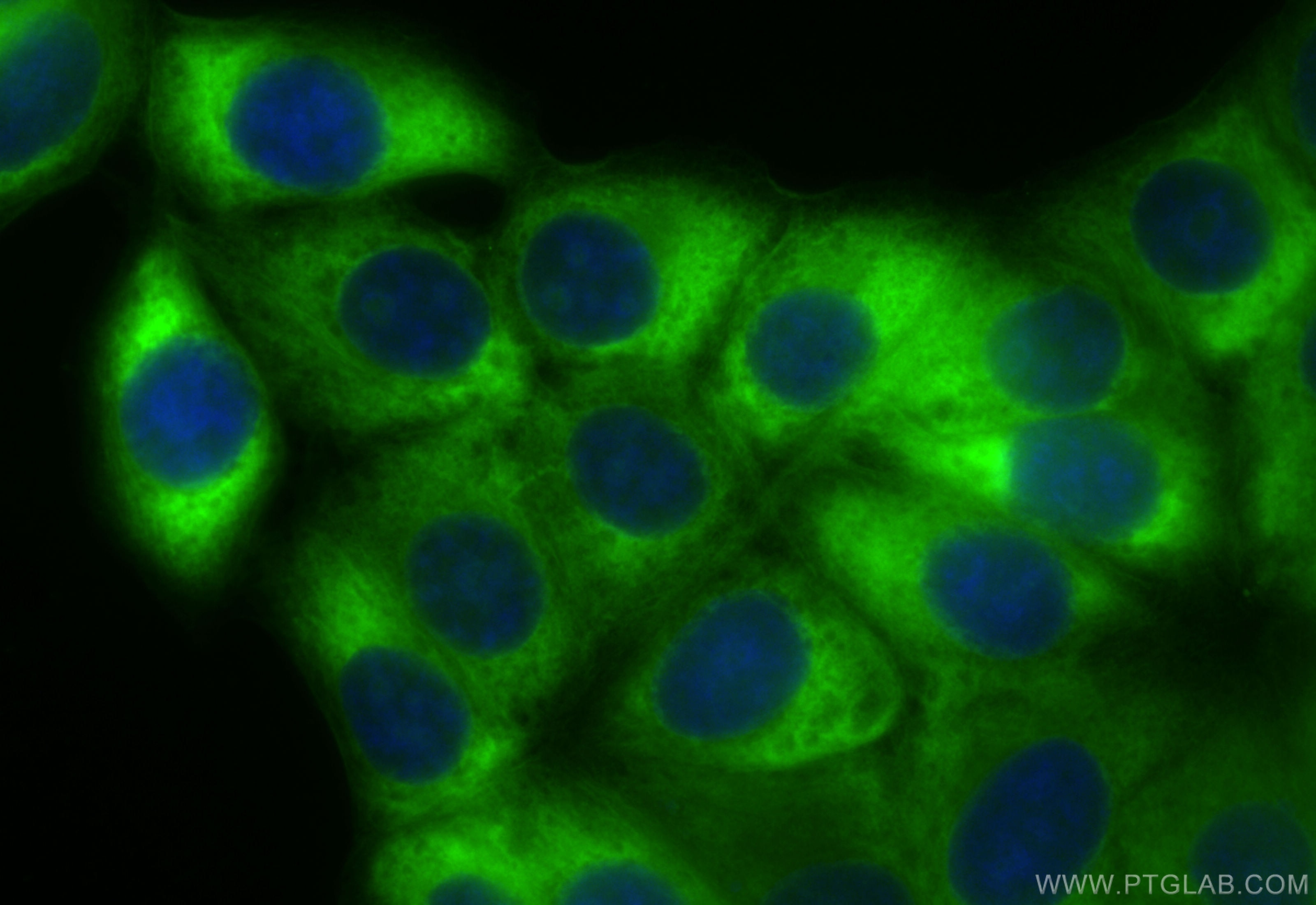 Immunofluorescence (IF) / fluorescent staining of MCF-7 cells using CoraLite® Plus 488-conjugated RPS4X Recombinant an (CL488-85040-5)