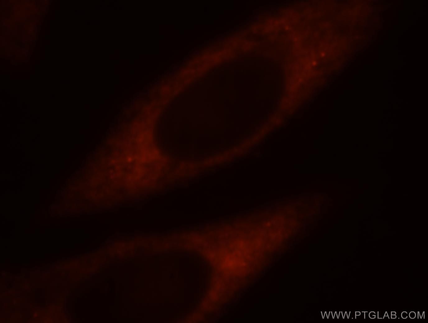 Immunofluorescence (IF) / fluorescent staining of HepG2 cells using RPS4Y1 Polyclonal antibody (17296-1-AP)