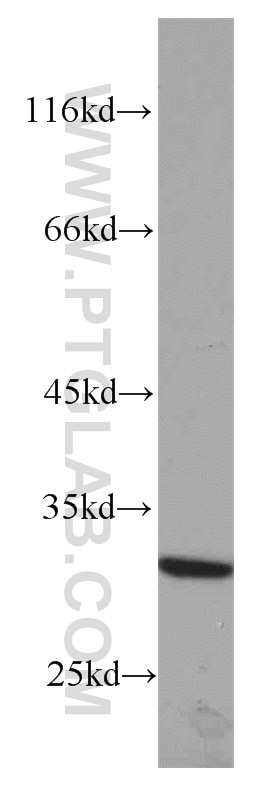 Western Blot (WB) analysis of mouse ovary tissue using RPS4Y1 Polyclonal antibody (17296-1-AP)