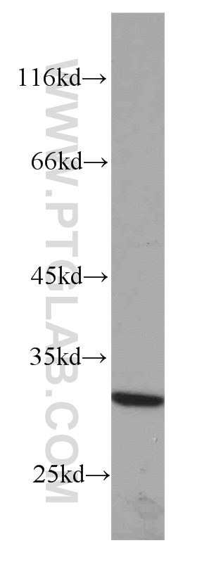 Western Blot (WB) analysis of mouse ovary tissue using RPS4Y1 Polyclonal antibody (17296-1-AP)