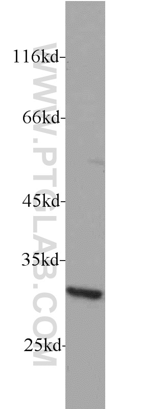 Western Blot (WB) analysis of HeLa cells using RPS4Y1 Polyclonal antibody (17296-1-AP)