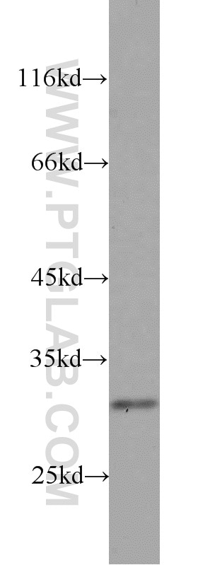 Western Blot (WB) analysis of DU 145 cells using RPS4Y1 Polyclonal antibody (17296-1-AP)