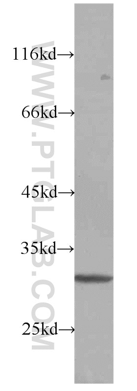 Western Blot (WB) analysis of A2780 cells using RPS4Y1 Polyclonal antibody (17296-1-AP)