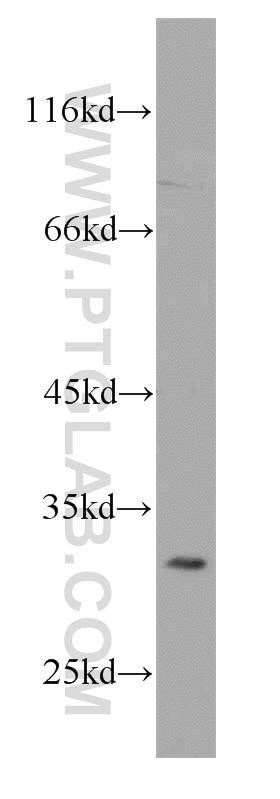 Western Blot (WB) analysis of SKOV-3 cells using RPS4Y1 Polyclonal antibody (17296-1-AP)