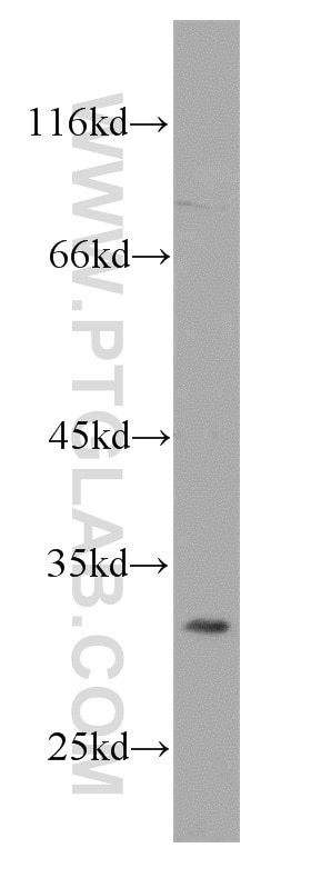 Western Blot (WB) analysis of SKOV-3 cells using RPS4Y1 Polyclonal antibody (17296-1-AP)