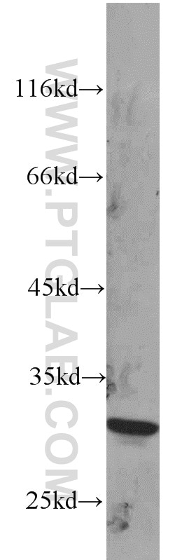 Western Blot (WB) analysis of mouse testis tissue using RPS4Y1 Polyclonal antibody (17296-1-AP)