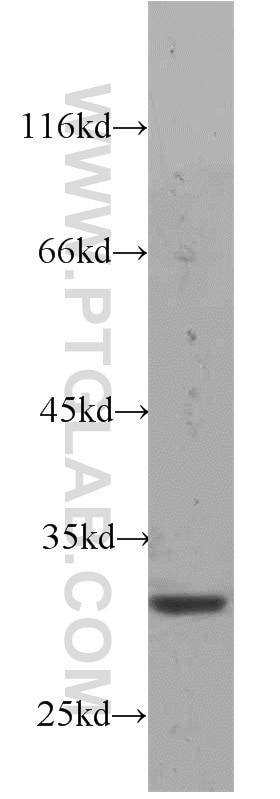 Western Blot (WB) analysis of DU 145 cells using RPS4Y1 Polyclonal antibody (17296-1-AP)