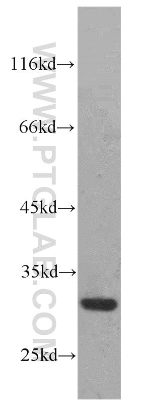 Western Blot (WB) analysis of A2780 cells using RPS4Y1 Polyclonal antibody (17296-1-AP)