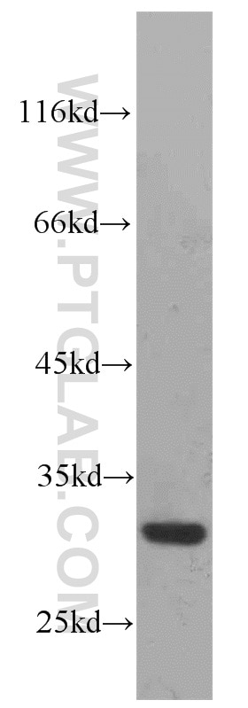 Western Blot (WB) analysis of A2780 cells using RPS4Y1 Polyclonal antibody (17296-1-AP)