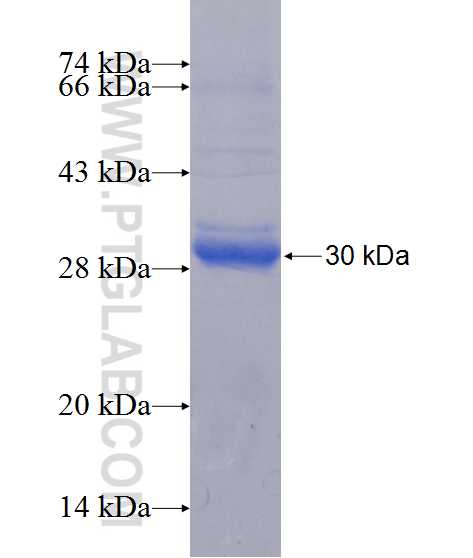RPS4Y1 fusion protein Ag11149 SDS-PAGE