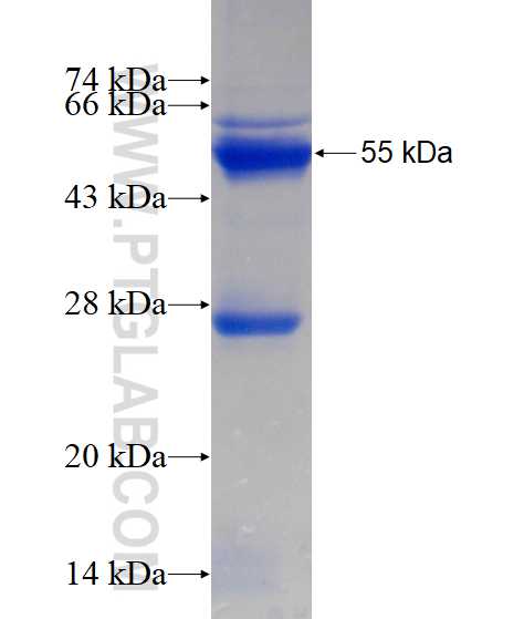 RPS4Y1 fusion protein Ag11176 SDS-PAGE
