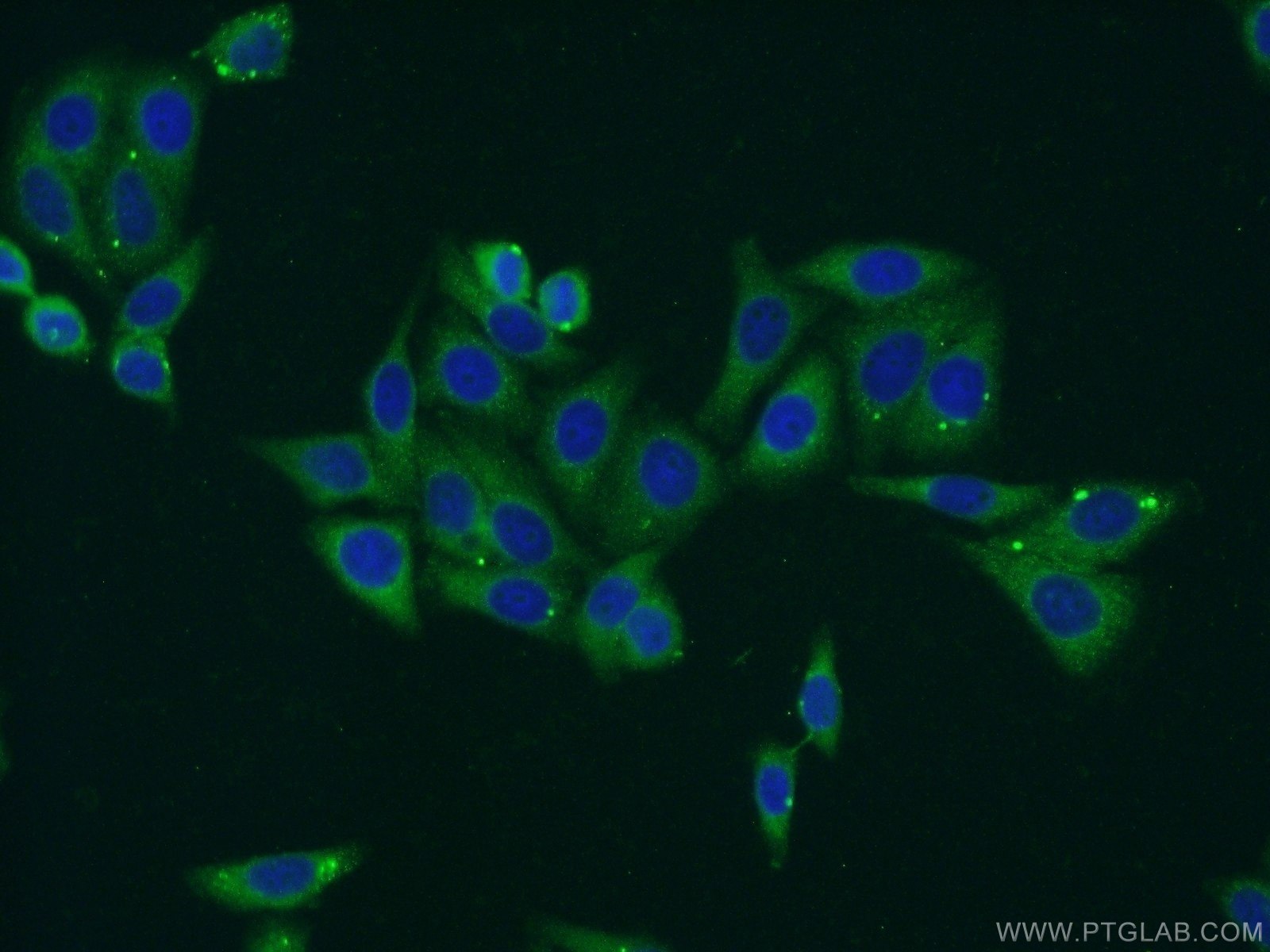 Immunofluorescence (IF) / fluorescent staining of HepG2 cells using RPS5 Polyclonal antibody (16964-1-AP)
