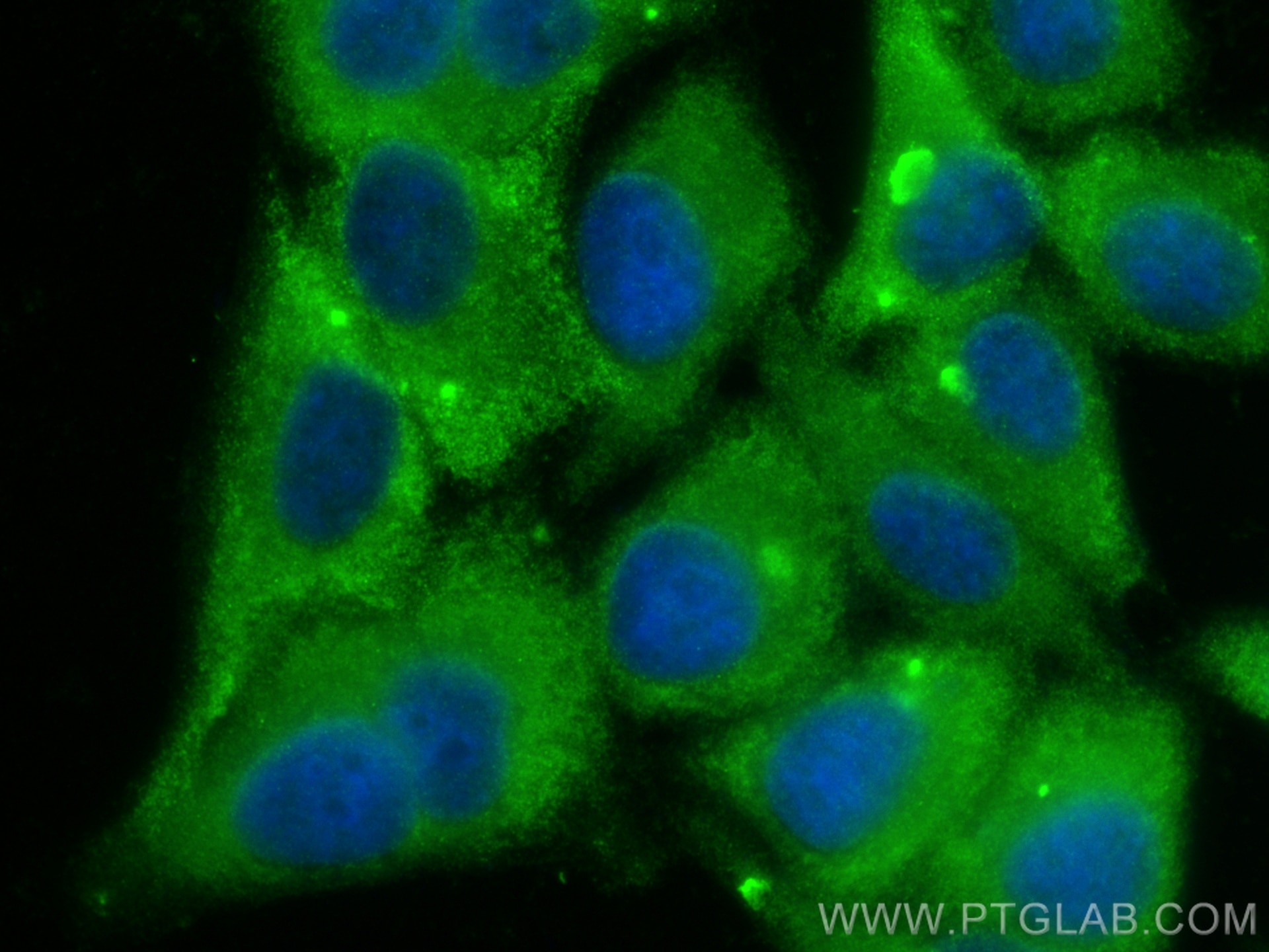 Immunofluorescence (IF) / fluorescent staining of HepG2 cells using RPS5 Polyclonal antibody (16964-1-AP)