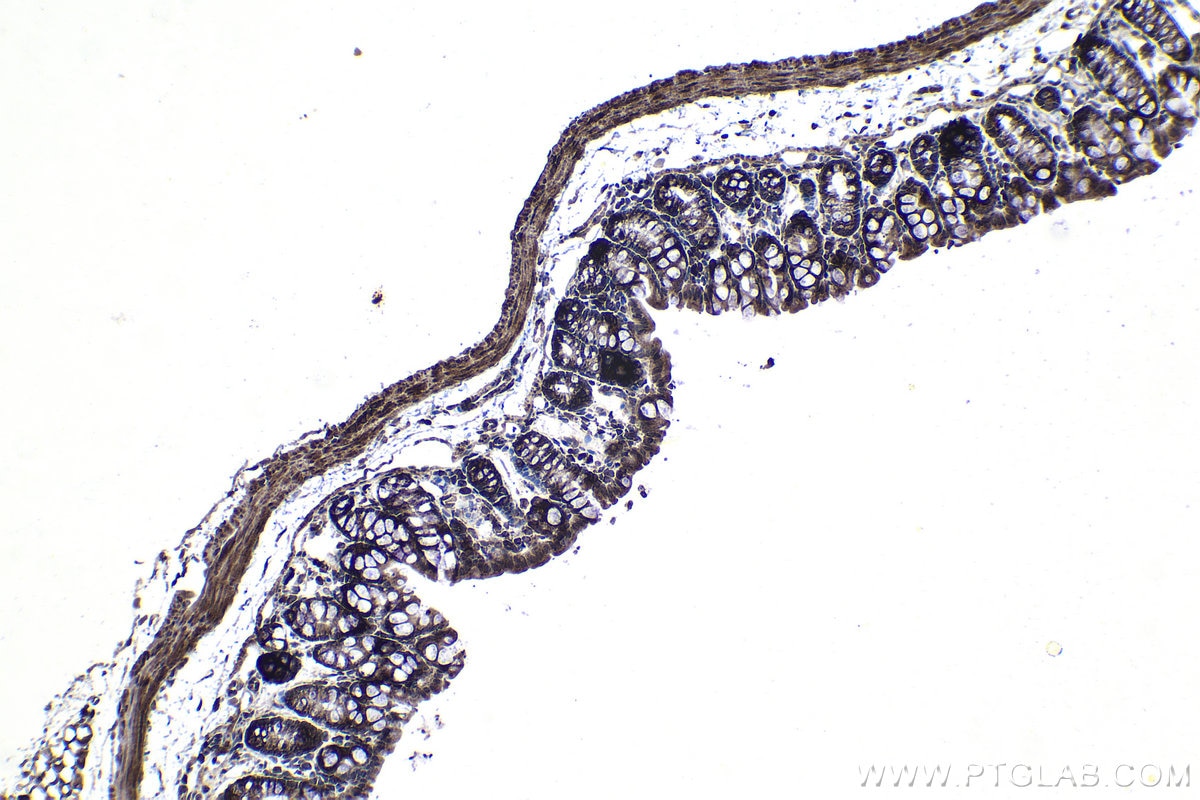 IHC staining of mouse colon using 16964-1-AP