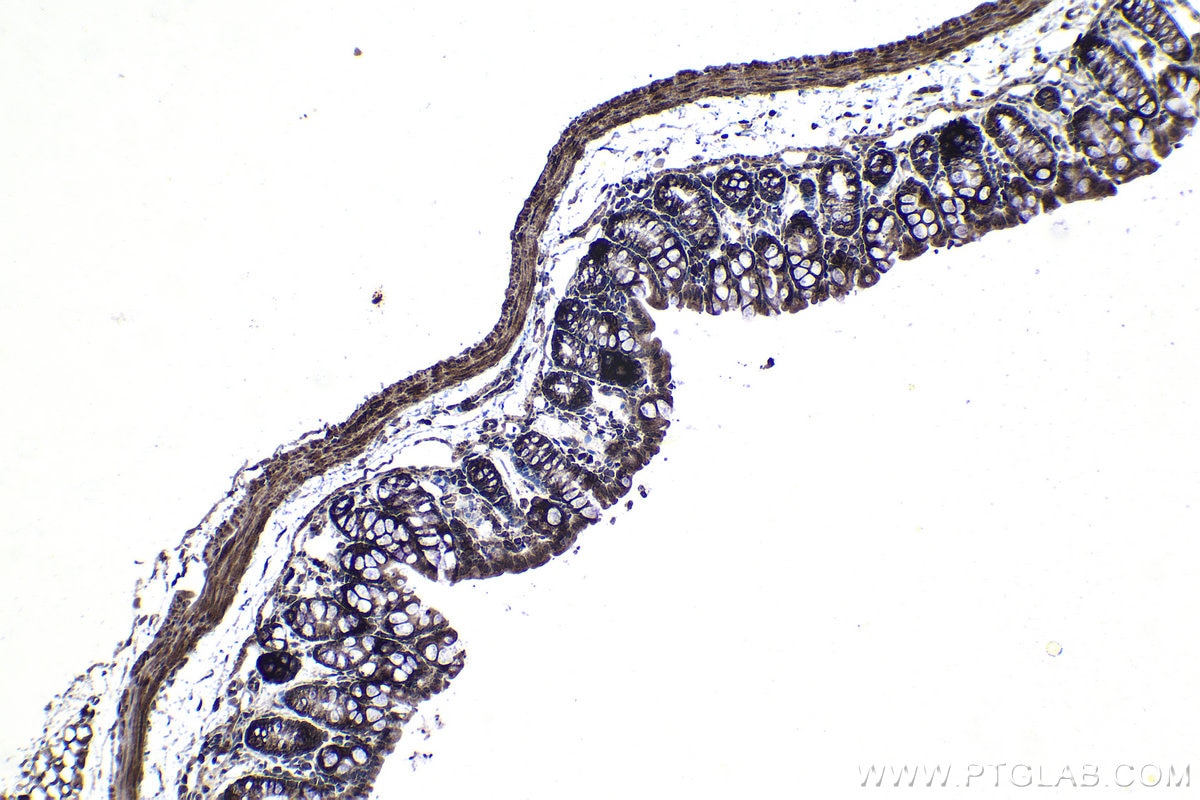 Immunohistochemistry (IHC) staining of mouse colon tissue using RPS5 Polyclonal antibody (16964-1-AP)