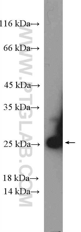 Western Blot (WB) analysis of mouse liver tissue using RPS5 Polyclonal antibody (16964-1-AP)