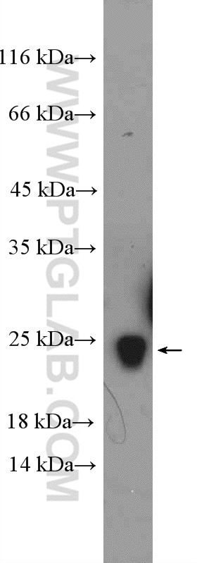 Western Blot (WB) analysis of rat liver tissue using RPS5 Polyclonal antibody (16964-1-AP)