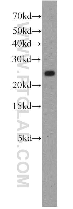 Western Blot (WB) analysis of HeLa cells using RPS5 Polyclonal antibody (16964-1-AP)