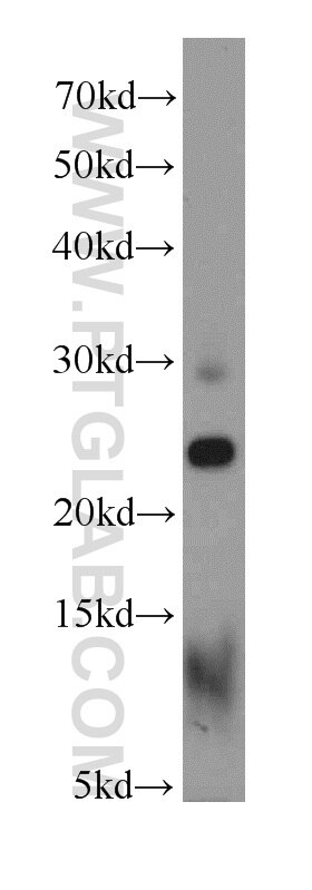 Western Blot (WB) analysis of HepG2 cells using RPS5 Polyclonal antibody (16964-1-AP)