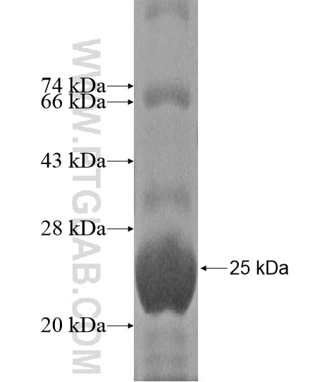 RPS5 fusion protein Ag10669 SDS-PAGE
